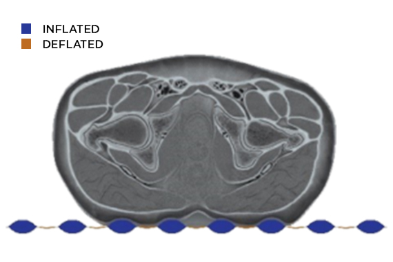 cross section of torso and Dabir surface